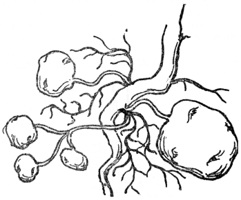 FIG. 8.—TUBERS OF THE COMMON POTATO Potatoes are swollen portions of rootstock.